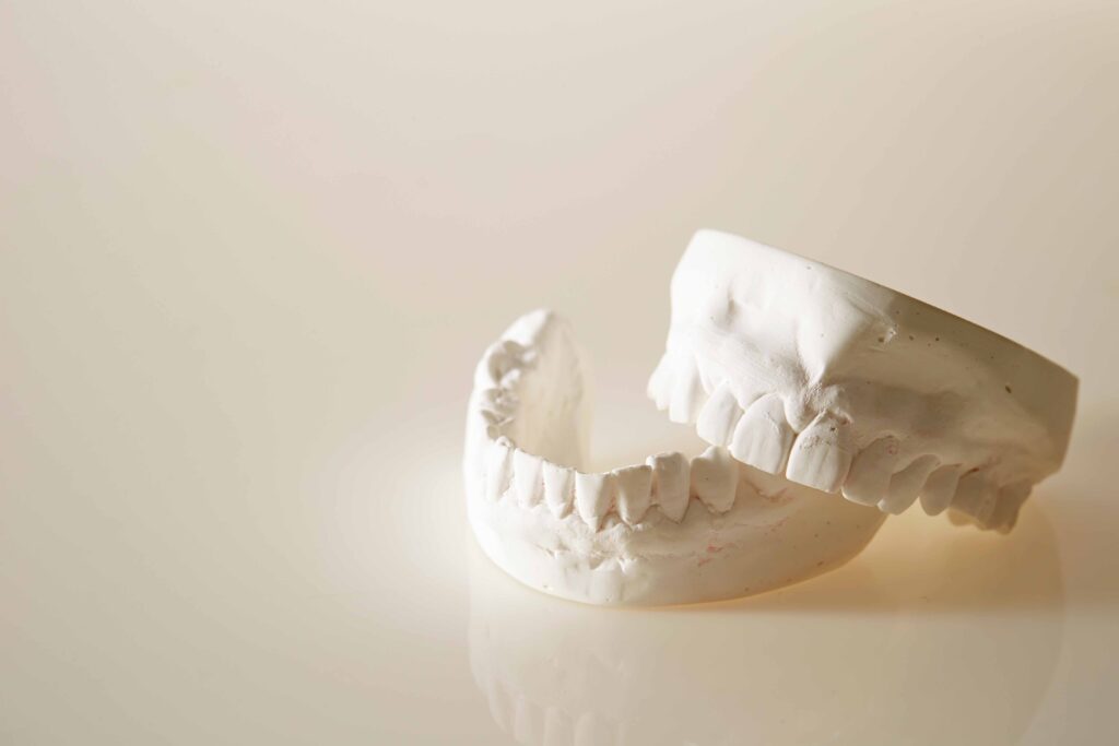 型取りされた歯の模型